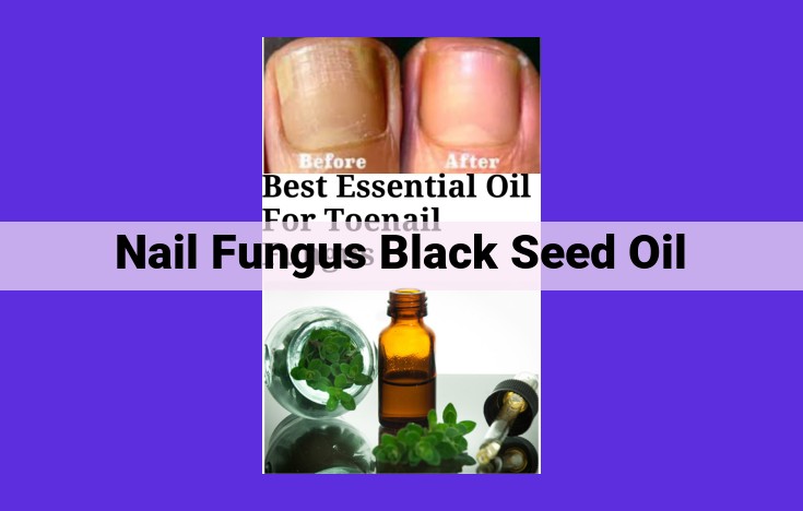 Black Seed Oil: A Natural Solution for Nail Fungus: Properties and Benefits