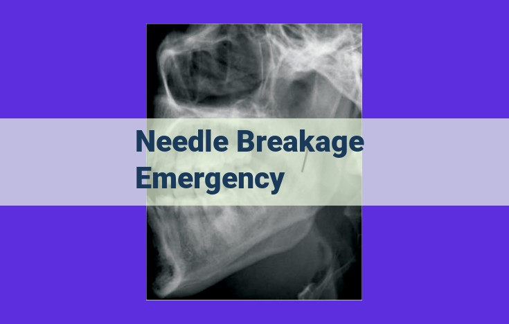 Needle Breakage Emergencies: Essential Safety Measures and Management Best Practices