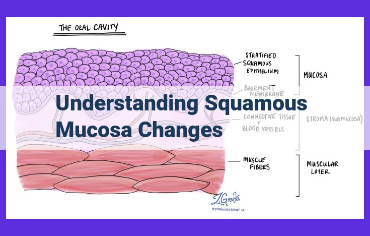 Understanding Squamous Mucosa Changes: Key Stages and Implications for Early Detection